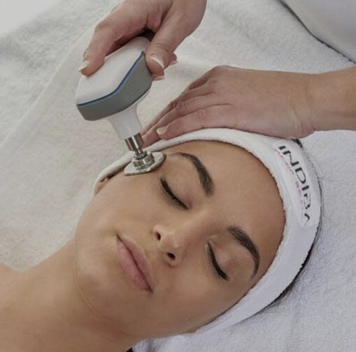 indiba facial